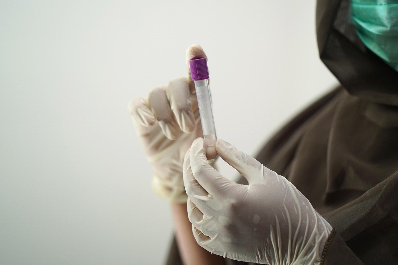 HIV Medical Tests